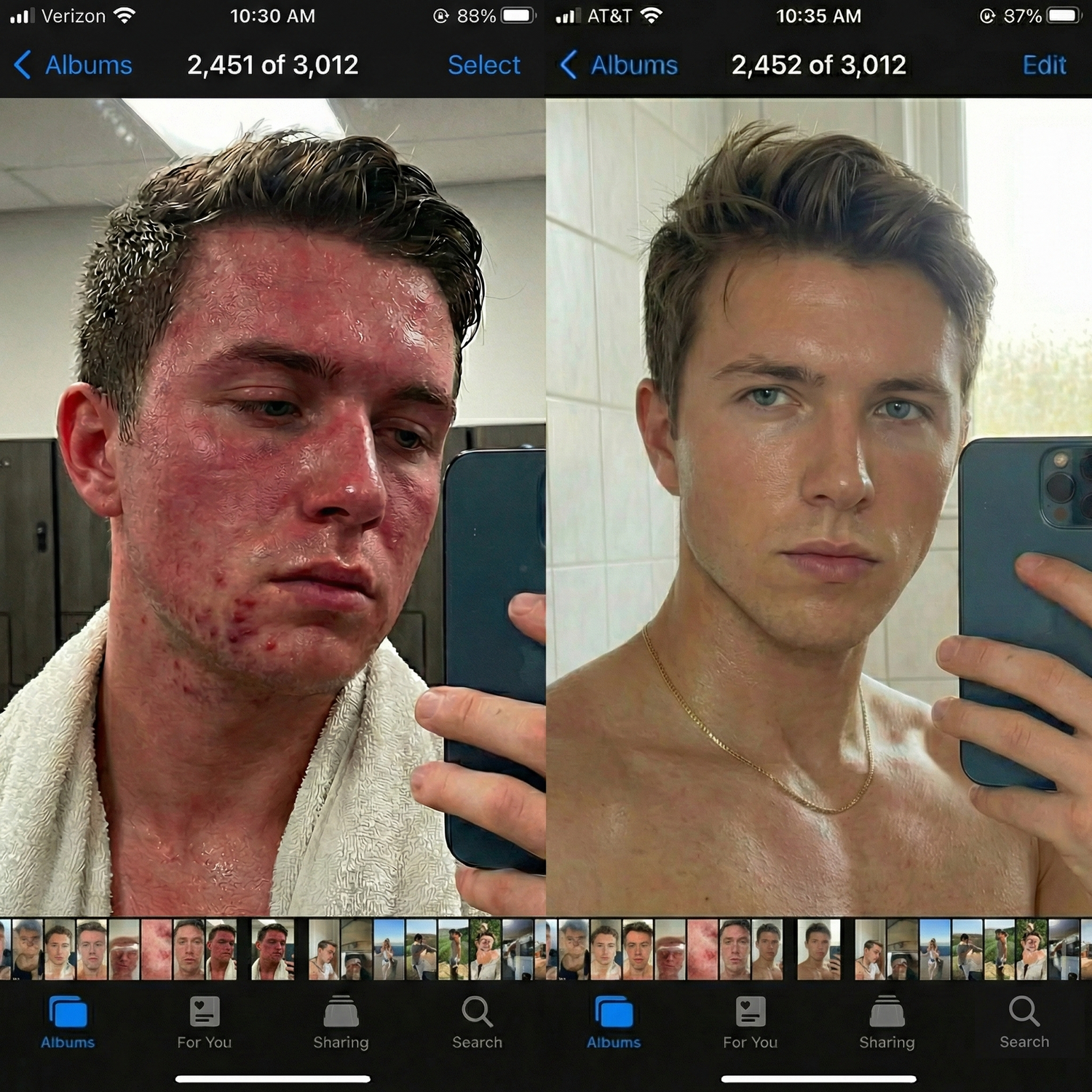 5 Reasons Korean Men Use These Toner Pads to Stop Breakouts