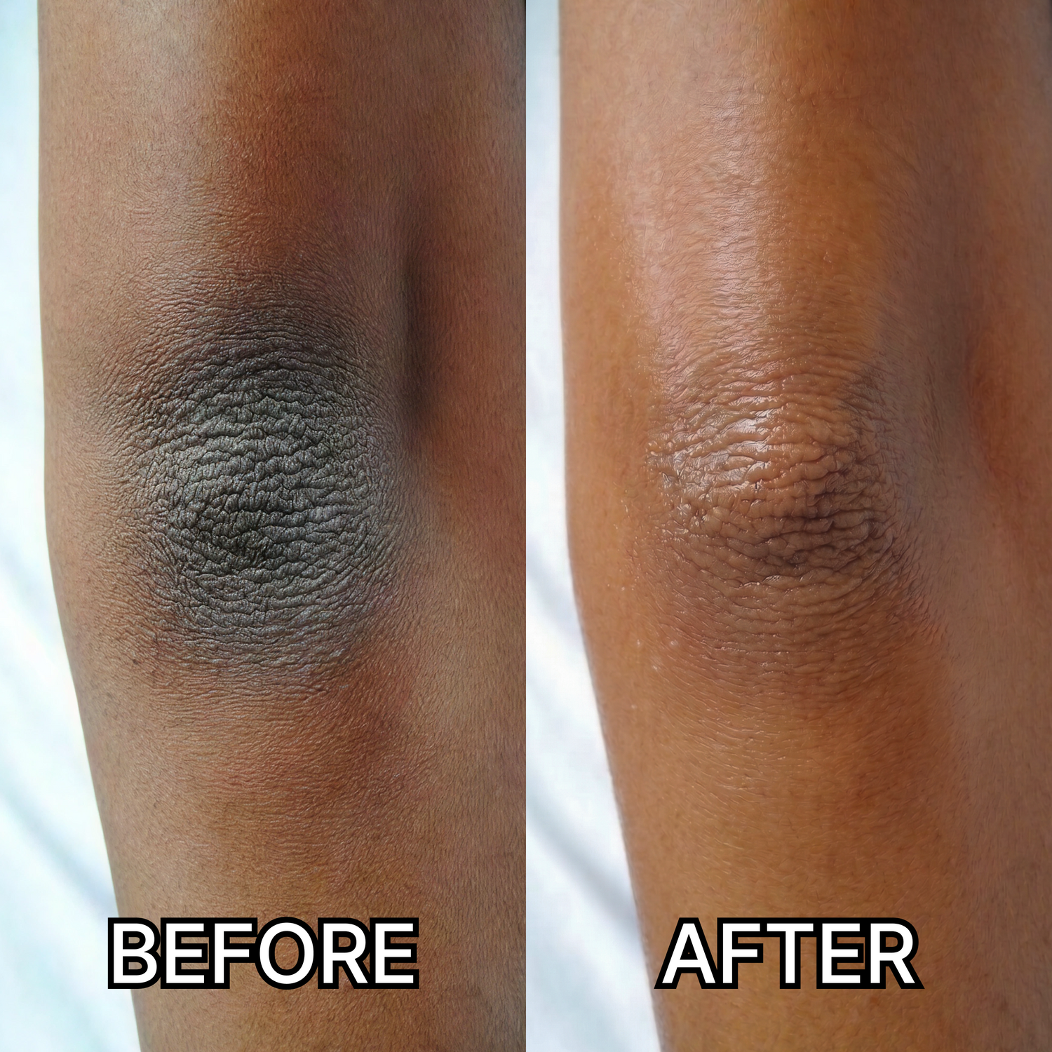 5 Reasons Korean Men Are Using This Serum for Ashy Elbows