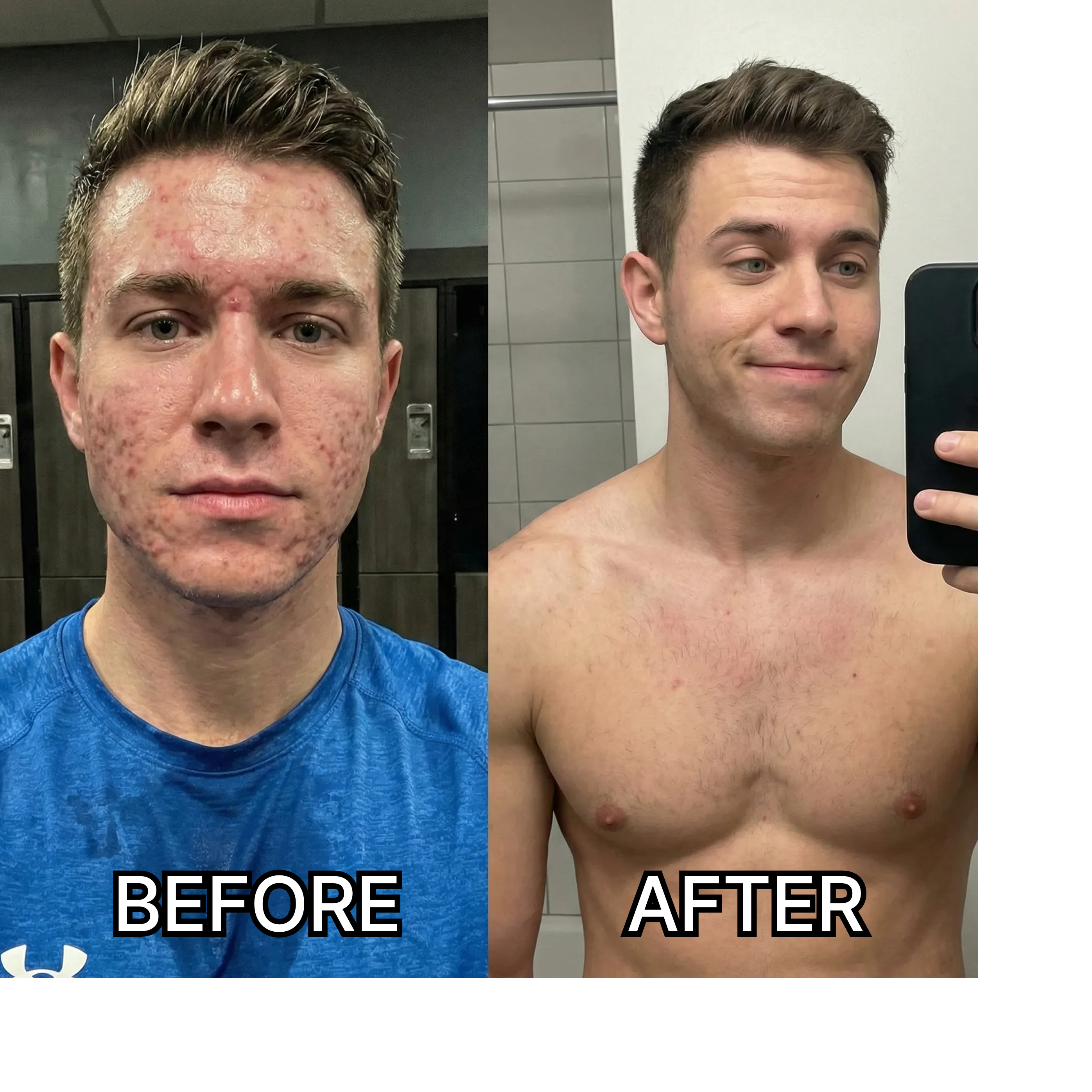 5 Reasons Why This Korean Serum Stops Acne Before It Starts