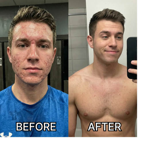5 Reasons Why This Korean Serum Stops Acne Before It Starts