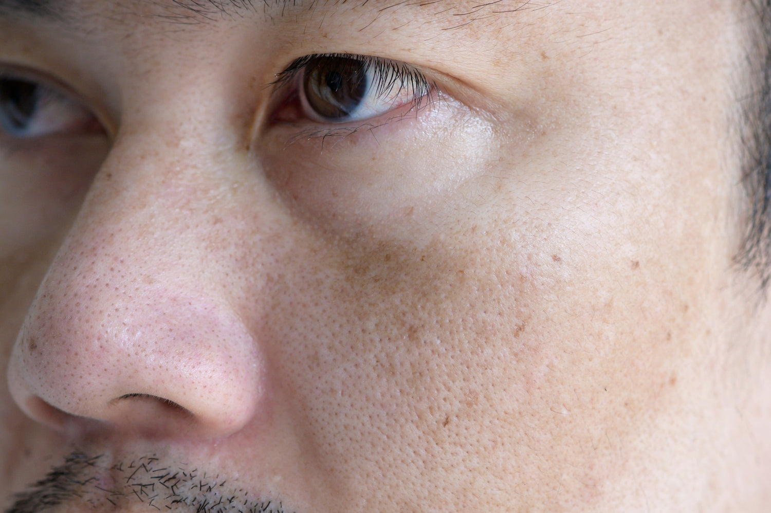 Got Pore Concerns? Start Pore Care with Cooling Toner