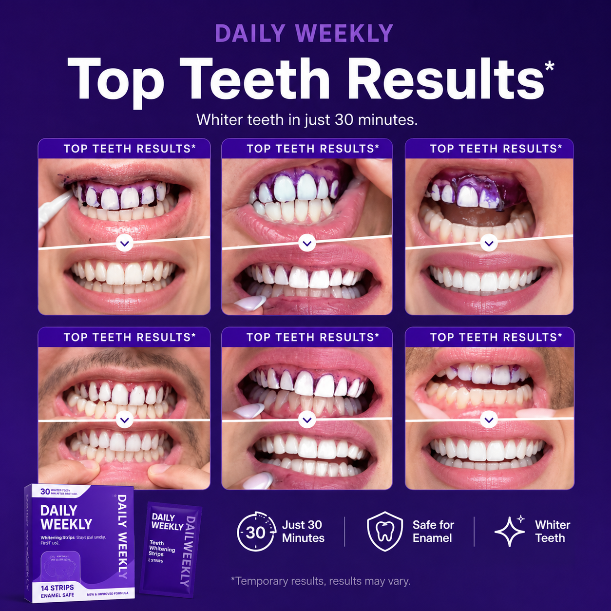 Purple Whitening Strips