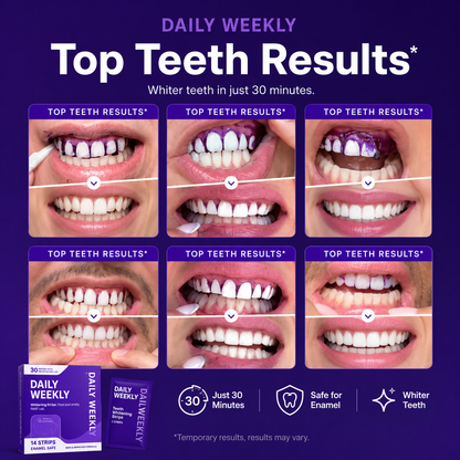 Purple Whitening Strips