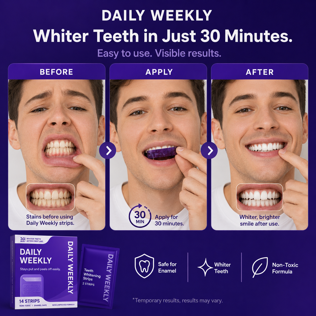 Purple Whitening Strips