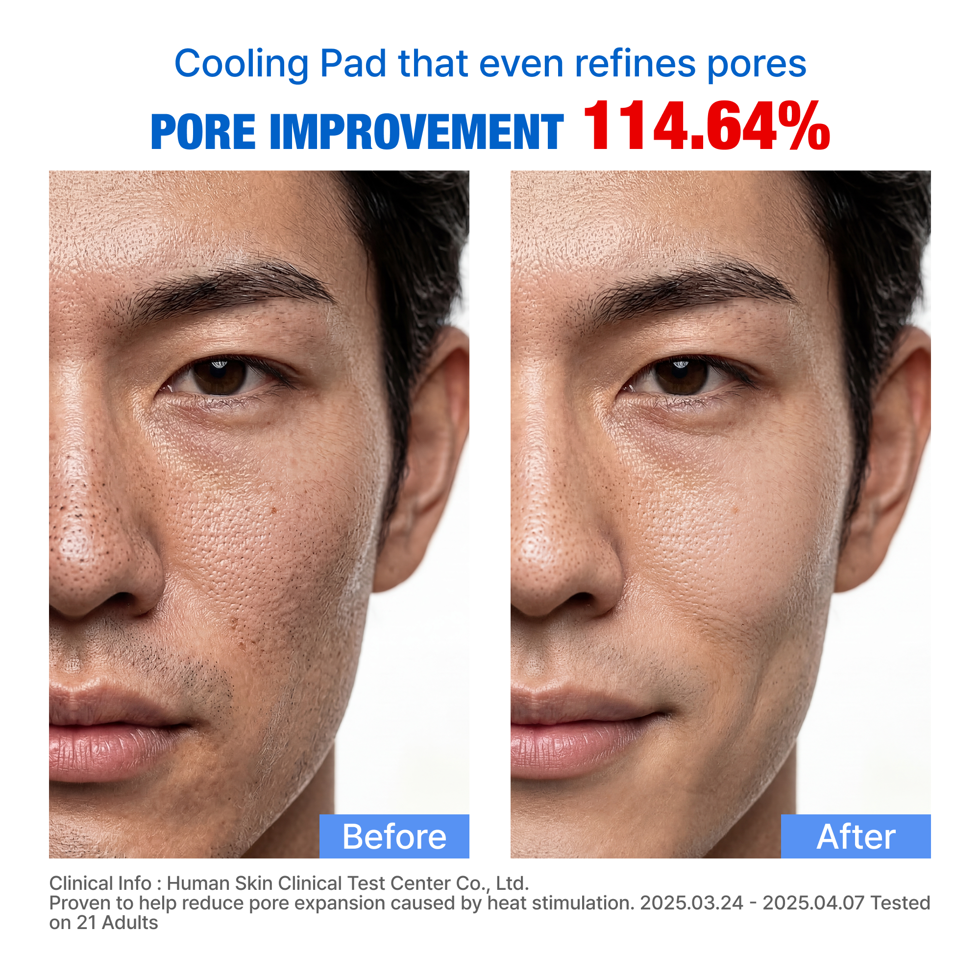 COOLASTING ICE PAD