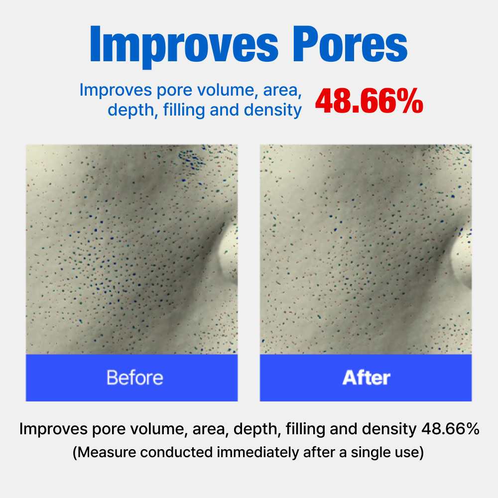 Sparkling Mask - 6 pack