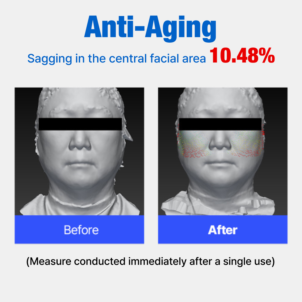 Sparkling Mask - 6 pack